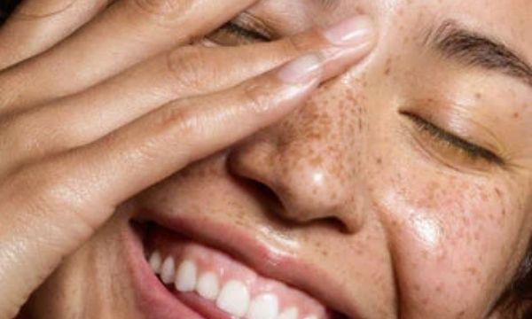 Skin Positivity: Skin Concern-Free Beauty Influencers to Follow
