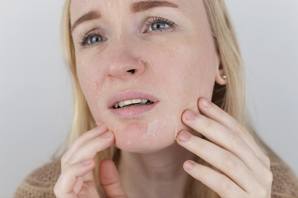 Top 5 Reasons to Choose Lava Art for Sensitive Skin